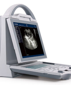 KX5600 Human Diagnostic Ultrasound