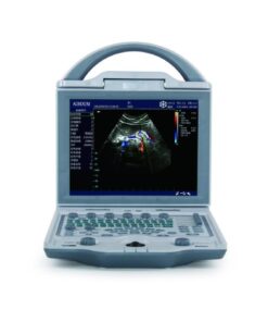 Alternative view of Portable Color Doppler Ultrasound DCU-12